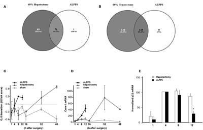 Exploration of the Transcriptional Landscape of ALPPS Reveals the Pathways of Accelerated Liver Regeneration